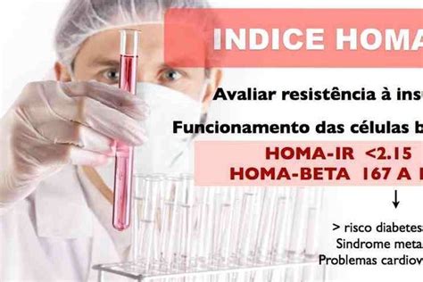 homa ir alto e homa beta baixo - homa beta baixo o que significa